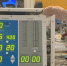 Инженеры NASA собрали эффективный аппарат искусственной вентиляции легких из доступных деталей - Кубанские Новости