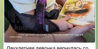 В Краснодаре двухлетняя малышка вернулась из детсада со сломанным плечом - Югополис
