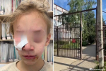 Пострадавшая